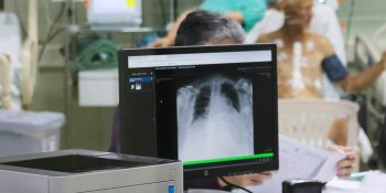 Hospital firma parcerias para reduzir a fila de cirurgias e procedimentos cardíacos